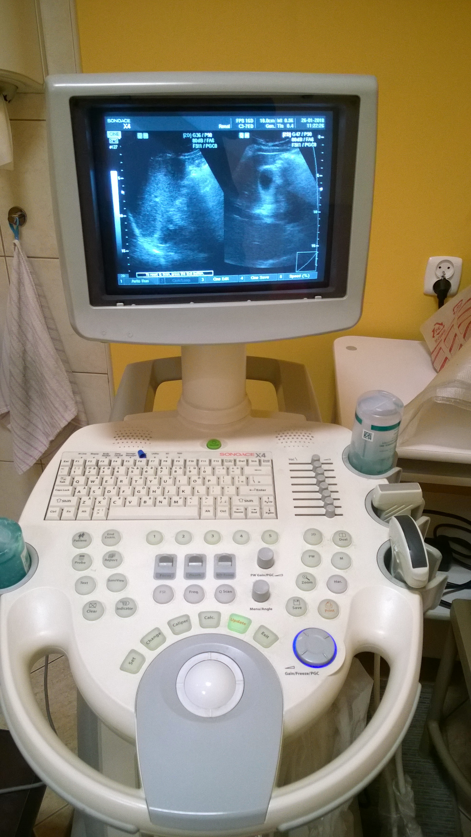 APARAT USG MEDISON SONOACE X4